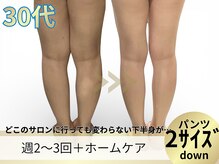 ヨサパーク ア モード ミオ 柴又店(YOSA PARK A modo mio)/どんな太もももご相談ください♪