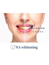 NAホワイトニング 船橋店/セルフホワイトニング/船橋