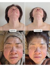 オラ(Ola)/60代/120分後