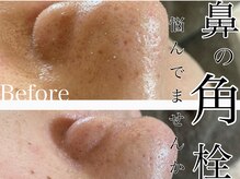 グレイティア(gratia)/角栓・詰まり改善！毛穴洗浄！！