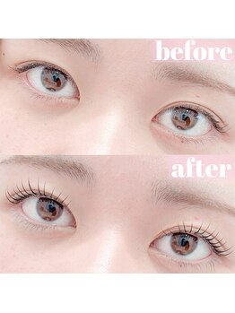 カナン(kanan)/before &nbsp;after 