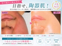 ユキエル(yukielle)