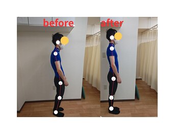 きぼう鍼灸整骨院の写真/仕事や育児で崩れてしまった姿勢をしっかり改善！根本改善することでお身体の調子も長持ち！