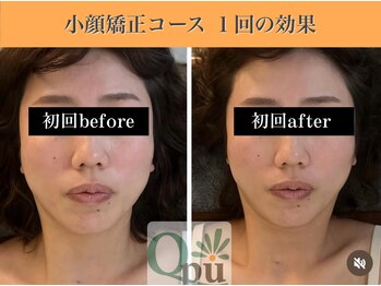 キュープ 表参道店(Qpu)/結果が出るから続けられる!