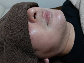 脱毛サロンLumiRei　おいらせ町店～全身・部分脱毛/ヒゲ/VIO/男性・女性・キッズ～の写真/毎日の髭剃りを楽に◎ヒゲやVIOも対応！自信あふれる素肌作りをプロがしっかりサポート♪