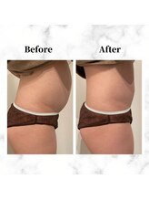 ザビューティー 麻布十番本店(The Beauty)/12Dリフトお腹美くびれ[リフト]