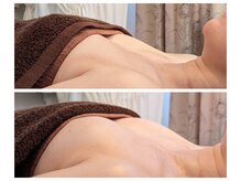 エル(eL)/Before/After