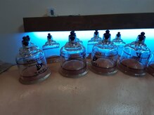 ホグ(Hogu)/カッピング