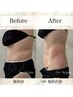 【即日実感】脂肪冷却4cup×脂肪分解×ラジオ波×EMS×引き締め美容液×マ