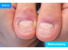 ネイルカンパニー/