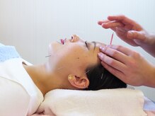 坂下通りべんてん鍼灸 整骨院/