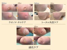 巻き爪補正店 赤羽店の雰囲気（固いタコ、魚の目による痛み、踵の角質でお悩みの方へ［赤羽］）