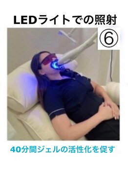 ホワイトニングショップ 今治店/ホワイトニング方法6