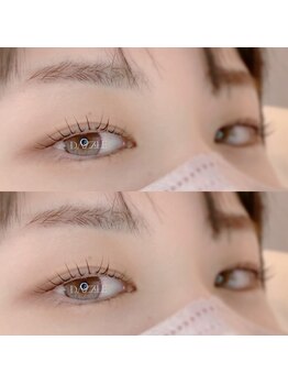 ダズル(DAZZLE)/ラッシュリフト（マツパ）