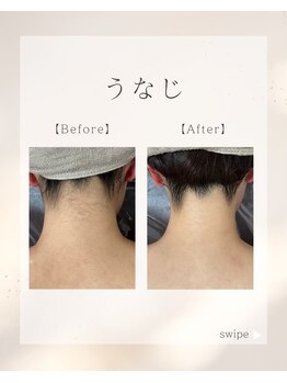 ルウム 大垣店(lum)/【脱毛サロン】うなじ脱毛
