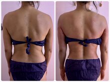 イーリバイブ/浮き輪肉撃退最強痩身マシン