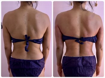 イーリバイブ/浮き輪肉撃退最強痩身マシン