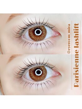 アイルームミラ 恵比寿店(mira)/上下ラッシュリフト☆初回¥8700