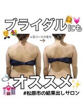 ステラ(stella)/赤みが出る場合もあります。