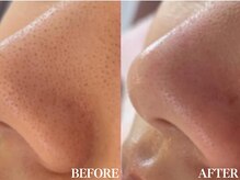 サロン ムスブ(salon MUSUBU)/山梨エステ/甲府エステ