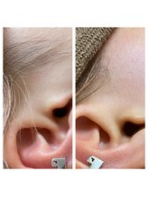 サロンアンドスクール ローズマリー (Salon&School Rosemary)/もみあげワックス光併用　¥3300