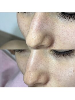 シャイニー(SHINY)/30代女性