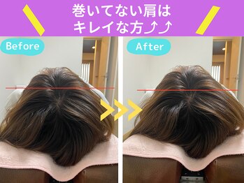 京都中丸整体カイロプラクティック/まき肩