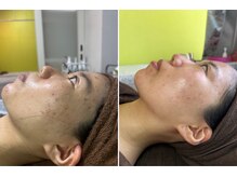 エムアイ 六本木(Mi)/