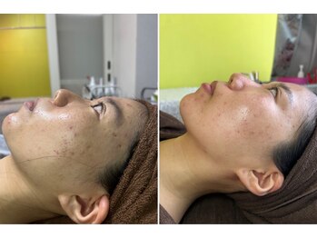 エムアイ 六本木(Mi)/