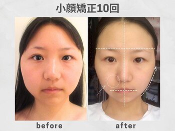 ビトリア 小顔 骨盤美容矯正サロン(BITORIA)/小顔頭蓋骨矯正