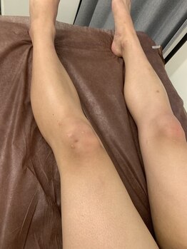キレピア 新市街店(kirepia)の写真/【毎朝のヒゲ剃り、もう終わりにしませんか？】お肌すべすべの清潔感あふれるイマドキ男子になりましょう☆