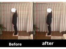 リリス(Lylis)/お客様ビフォー/アフター