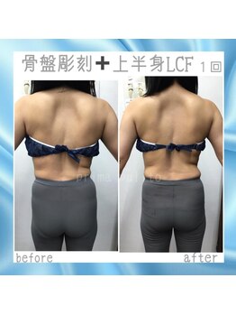 プリマプリート 各務原店/骨盤の歪み＆巻き肩