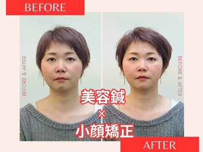 マッチ鍼灸整骨院の写真