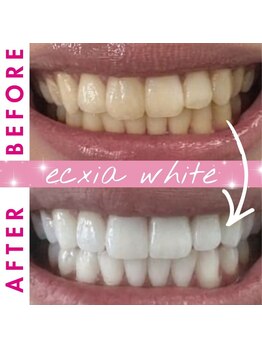 エクシアホワイト 倉吉店(ecxia white)/ビフォーアフター