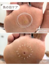 ドクターネイル爪革命 THE KANAZAWA 御経塚/魚の目ケア