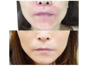 我楽 南浦和/本来の素肌へ導くフェイシャル