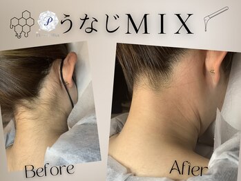 プラチナワックス(Platine Wax)/うなじ★MIX脱毛［WAX＆FLASH］