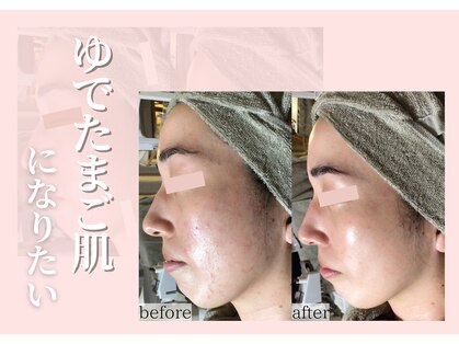 フレク(fleque)の写真