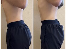 前体重が正しく立てるように♪お腹の肌荒れもなくなりました