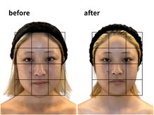 青空 天神大名店(SORA)/ハチ張りもスッキリ！速攻小顔に