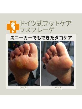 フスフレーゲ 学芸大学店/スニーカーでできたタコのお悩み