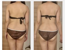 ボンヌシャンスビューティの雰囲気(一度のbefore after肋骨・背中・ウエスト・ヒップもスッキリ。 )