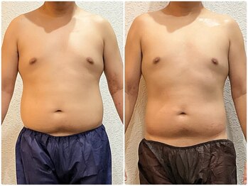 美容整体 ウェリナ 蟹江院/小顔矯正/骨盤矯正/美脚サロン