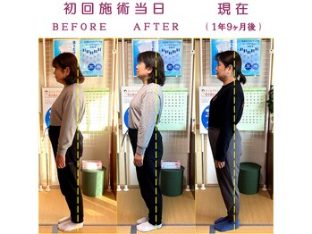 やすらぎカイロ施術院/施術前後