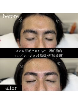ユー 西船橋店(you)/ビフォーアフター写真
