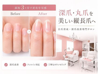 カンナ(Kanna)の写真