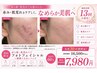 【先着30名】赤ら顔・肌荒れ改善フォト+鎮静パック¥16,500→¥7,980
