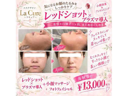 ラキュア(La Cure)の写真