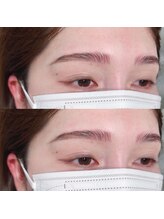 ビスチェ(VISCHE)/ハリウッドブロウリフト